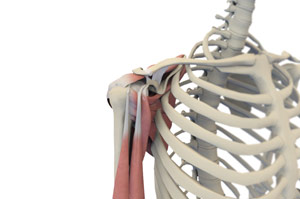 Shoulder Joint Replacement