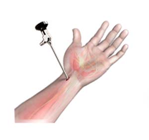 Arthroscopic Wrist Surgery